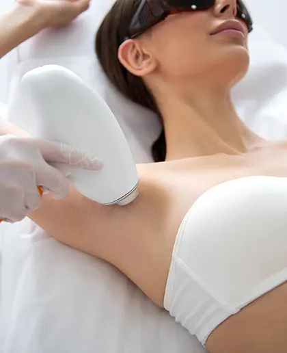 epilation au laser
